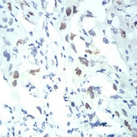 19 - Anti-Importin alpha 2 Antibody AP95911