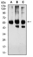 1 - Anti-Importin alpha 2 Antibody AP95911