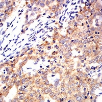 19 - Anti-Cytokeratin 10 Antibody AP95912