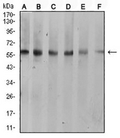 1 - Anti-Cytokeratin 10 Antibody AP95912