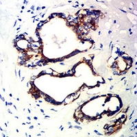 19 - Anti-Cytokeratin 10 Antibody AP95913