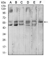 1 - Anti-Cytokeratin 10 Antibody AP95913