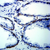 19 - Anti-Cytokeratin 13 Antibody AP95914