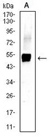 1 - Anti-Cytokeratin 13 Antibody AP95914