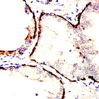 19 - Anti-Cytokeratin 14 Antibody AP95915
