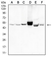 1 - Anti-Cytokeratin 14 Antibody AP95915