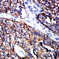 19 - Anti-Cytokeratin 15 Antibody AP95916