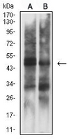 1 - Anti-Cytokeratin 15 Antibody AP95916