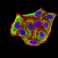 3 - Anti-Cytokeratin 18 Antibody AP95917