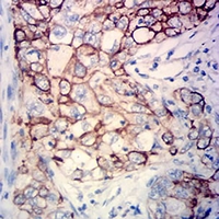 19 - Anti-Cytokeratin 18 Antibody AP95917