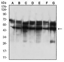 1 - Anti-Cytokeratin 18 Antibody AP95917