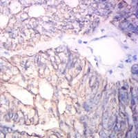 19 - Anti-Cytokeratin 19 Antibody AP95918