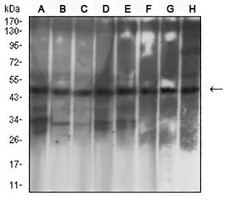 1 - Anti-Cytokeratin 19 Antibody AP95918