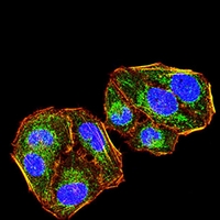 3 - Anti-Cytokeratin 2 Antibody AP95919