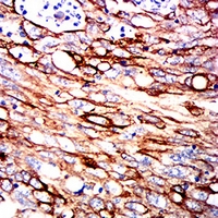 19 - Anti-Cytokeratin 2 Antibody AP95919