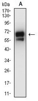1 - Anti-Cytokeratin 2 Antibody AP95919