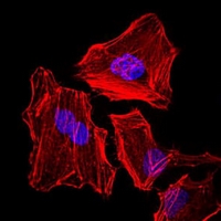 3 - Anti-Cytokeratin 5 Antibody AP95920
