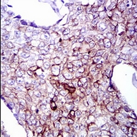 19 - Anti-Cytokeratin 5 Antibody AP95920