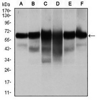 1 - Anti-Cytokeratin 5 Antibody AP95920
