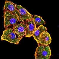 3 - Anti-Cytokeratin 6 Antibody AP95921