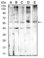 1 - Anti-Cytokeratin 6 Antibody AP95921