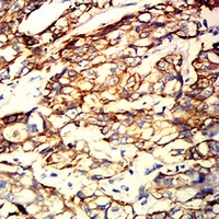 19 - Anti-Cytokeratin 9 Antibody AP95922