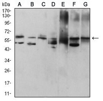 1 - Anti-Cytokeratin 9 Antibody AP95922
