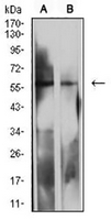 1 - Anti-CD85d Antibody AP95927
