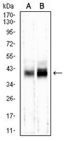 1 - Anti-M6PR Antibody AP95933
