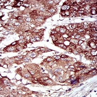 19 - Anti-MKK5 Antibody AP95935