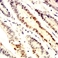 19 - Anti-HPK1 Antibody AP95936