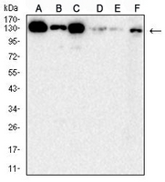 1 - Anti-HPK1 Antibody AP95936