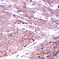 19 - Anti-MARK3 Antibody AP95939