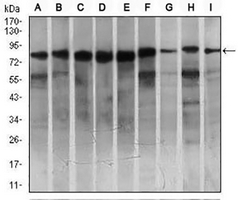 1 - Anti-MARK3 Antibody AP95939