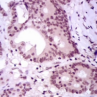 19 - Anti-MEF2C Antibody AP95943