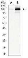 1 - Anti-MERTK Antibody AP95944