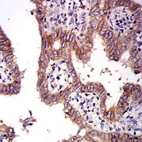 19 - Anti-c-Met Antibody AP95945