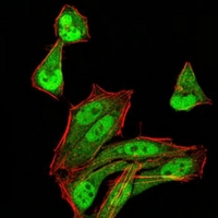 3 - Anti-MGMT Antibody AP95946