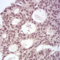 19 - Anti-MGMT Antibody AP95946