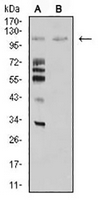 1 - Anti-MIB1 Antibody AP95947
