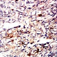 19 - Anti-CD10 Antibody AP95950