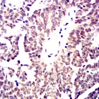 19 - Anti-MRE11 Antibody AP95952