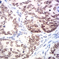 19 - Anti-MSH2 Antibody AP95954