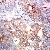19 - Anti-MSH6 Antibody AP95956