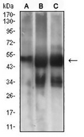 1 - Anti-MSH6 Antibody AP95956