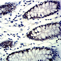 19 - Anti-MSH6 Antibody AP95957