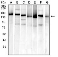 1 - Anti-MSH6 Antibody AP95957