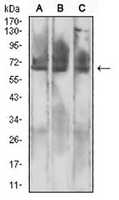 1 - Anti-Mesothelin Antibody AP95958