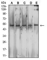 1 - Anti-CD204 Antibody AP95960