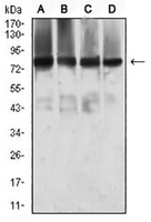 1 - Anti-MTA1 Antibody AP95962